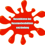 Nasenbluten bei Nasennebenhöhlenentzündung Nasenbluten bei Nasennebenhöhlenentzündung