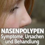 Nasenpolypen Symptome, Ursachen und Behandlung Nasenpolypen Symptome, Ursachen und Behandlung