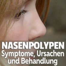Nasenpolypen Symptome